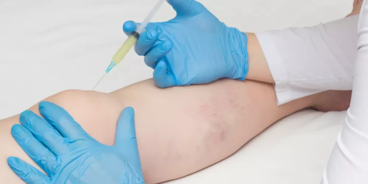 حقن الركبة الهيالورونيك