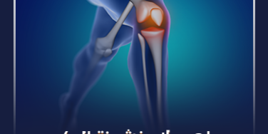 ماهو علاج خشونة الركبه_ ماهو علاج خشونة الركبه_