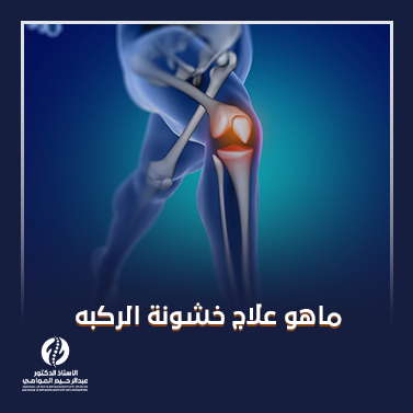 ماهو علاج خشونة الركبه_