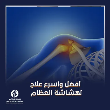 أفضل واسرع علاج لهشاشة العظام