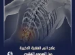 علاج الم الفقرة الاخيرة من العمود الفقري