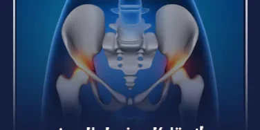 علاج تآكل مفصل الحوض