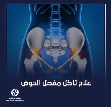 علاج تآكل مفصل الحوض