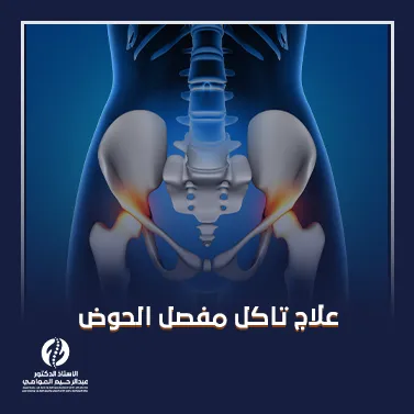 علاج تآكل مفصل الحوض