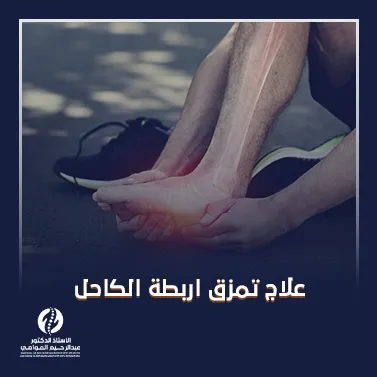 علاج تمزق اربطة الكاحل